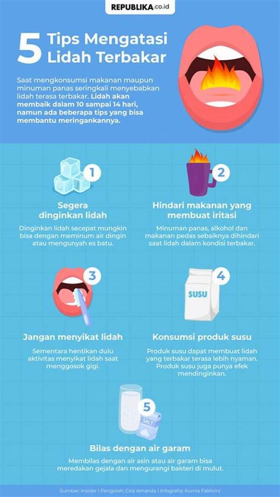 Tips Mengatasi Lidah Terbakar